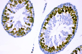 YB1/YBX1 Rabbit Polyclonal Antibody