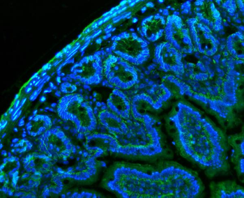 CD147/Bsg Rabbit Polyclonal Antibody