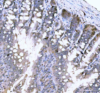 Chromogranin A/Chga Rabbit Polyclonal Antibody