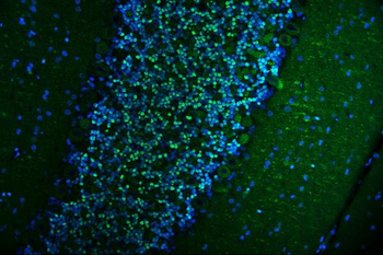 CAMKIV/Camk4 Rabbit Polyclonal Antibody
