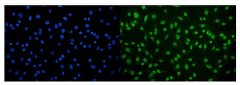CAMKIV/Camk4 Rabbit Polyclonal Antibody