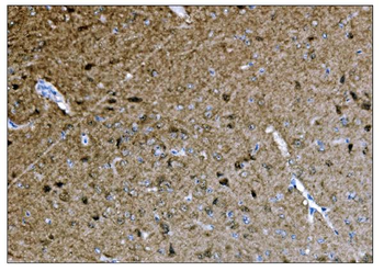 CAMKIV/Camk4 Rabbit Polyclonal Antibody