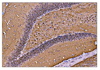 CAMKIV/Camk4 Rabbit Polyclonal Antibody