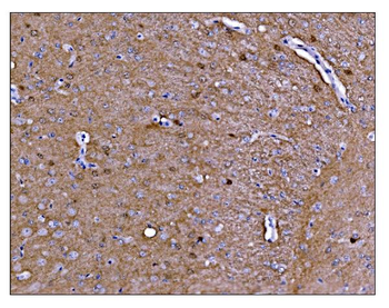 CAMKIV/Camk4 Rabbit Polyclonal Antibody