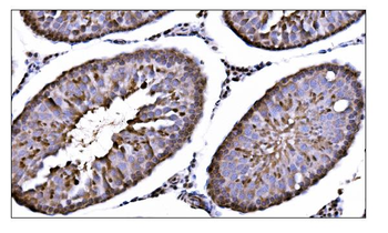 CAMKIV/Camk4 Rabbit Polyclonal Antibody