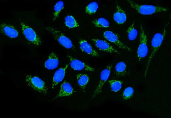 DLGAP1 Rabbit Polyclonal Antibody