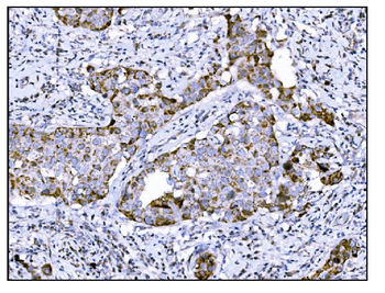 DLGAP1 Rabbit Polyclonal Antibody