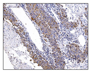 DLGAP1 Rabbit Polyclonal Antibody