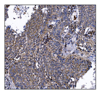 DLGAP1 Rabbit Polyclonal Antibody