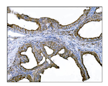 DLGAP1 Rabbit Polyclonal Antibody