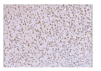 DLGAP1 Rabbit Polyclonal Antibody