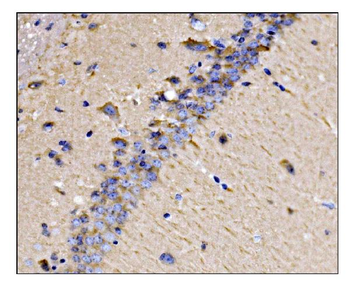 Dynamin 3/DNM3 Rabbit Polyclonal Antibody