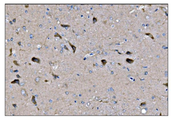 Dynamin 3/DNM3 Rabbit Polyclonal Antibody
