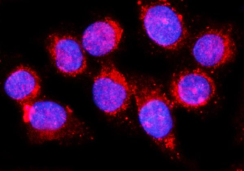 EHD1 Rabbit Polyclonal Antibody
