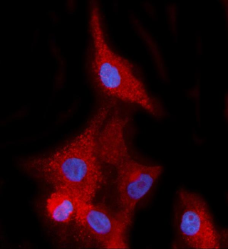 EHD2 Rabbit Polyclonal Antibody