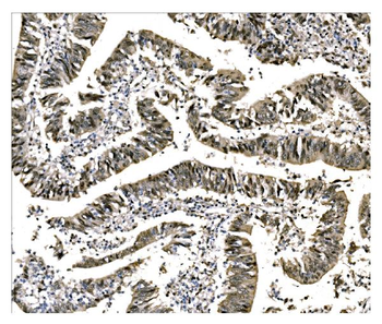 EHMT2/G9A Rabbit Polyclonal Antibody
