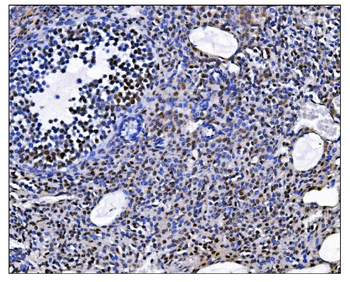 EHMT2/G9A Rabbit Polyclonal Antibody