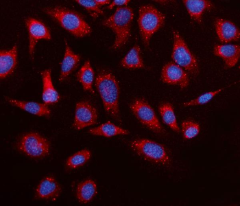 Elovl4 Rabbit Polyclonal Antibody