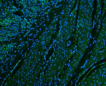 CD39/ENTPD1 Rabbit Polyclonal Antibody