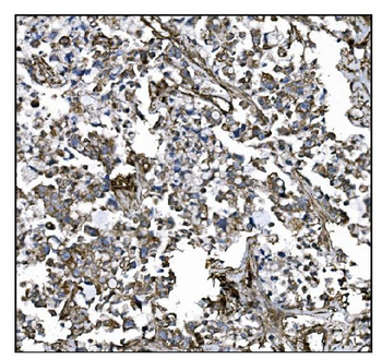 CD39/ENTPD1 Rabbit Polyclonal Antibody