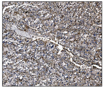 CD39/ENTPD1 Rabbit Polyclonal Antibody
