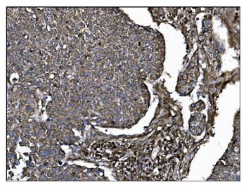 CD39/ENTPD1 Rabbit Polyclonal Antibody