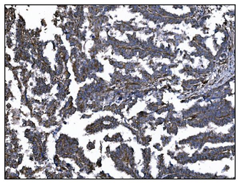 CD39/ENTPD1 Rabbit Polyclonal Antibody