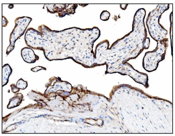 CD39/ENTPD1 Rabbit Polyclonal Antibody