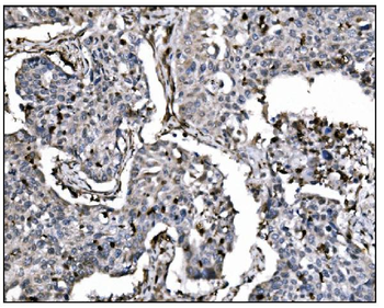 Fos B/FOSB Rabbit Polyclonal Antibody