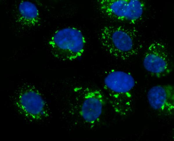 GOLPH2/GOLM1 Rabbit Polyclonal Antibody