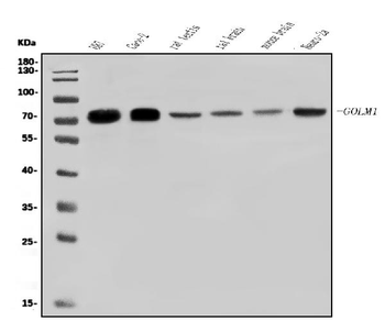 GOLPH2/GOLM1 Rabbit Polyclonal Antibody