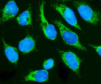 HCCS Rabbit Polyclonal Antibody