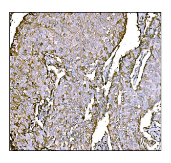 HCCS Rabbit Polyclonal Antibody