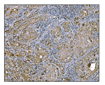 HCCS Rabbit Polyclonal Antibody