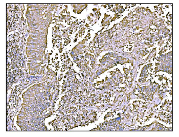 HCCS Rabbit Polyclonal Antibody