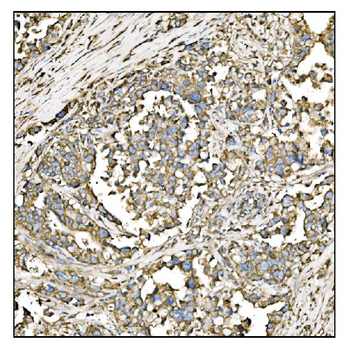 HCCS Rabbit Polyclonal Antibody