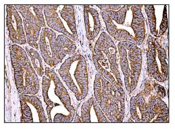 HCCS Rabbit Polyclonal Antibody
