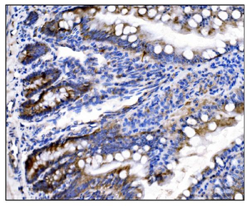HCCS Rabbit Polyclonal Antibody