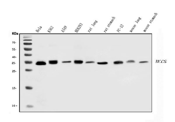 HCCS Rabbit Polyclonal Antibody