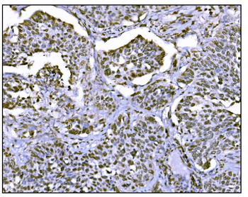 HDAC2 Rabbit Polyclonal Antibody