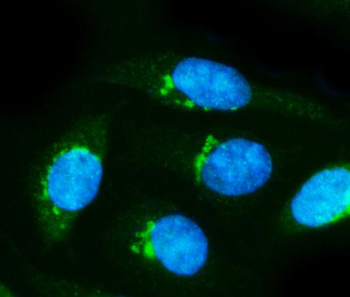 alpha Internexin/INA Rabbit Polyclonal Antibody