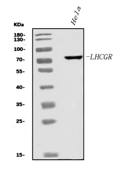 hCG receptor/LHR/LHCGR Rabbit Polyclonal Antibody