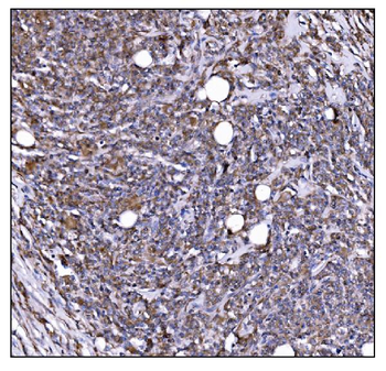 LILRB1 Rabbit Polyclonal Antibody