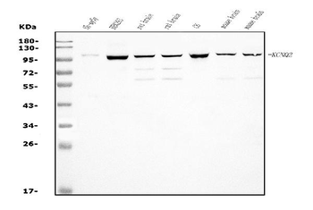 KCNQ2 Rabbit Polyclonal Antibody