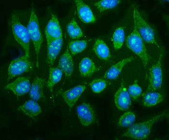 p38 gamma/MAPK12 Rabbit Polyclonal Antibody