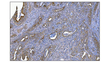 MERTK Rabbit Polyclonal Antibody