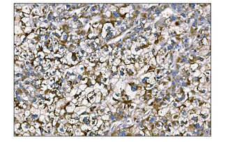 MERTK Rabbit Polyclonal Antibody