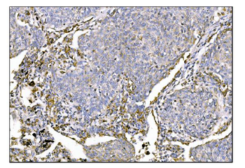 MERTK Rabbit Polyclonal Antibody