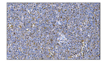 MERTK Rabbit Polyclonal Antibody