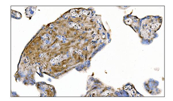MERTK Rabbit Polyclonal Antibody